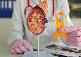Doctor holding a kidney model and yellow awareness ribbon in a medical clinic