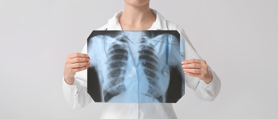 Female doctor with x-ray image of lungs on grey background