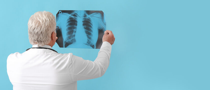 Senior doctor with x-ray image of lungs on color background