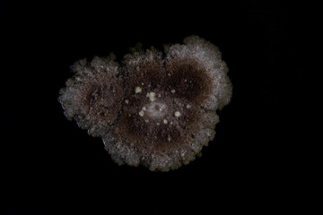 Melanoma on a black background. Dermatology, skin cancer