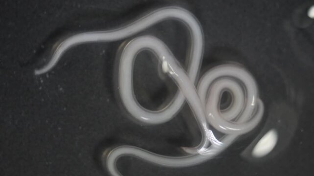 The nematodes (Nematoda), roundworms or eelworms constitute the phylum Nematoda. Species in the phylum inhabit a broad range of environments. Found in freshwater crabs.