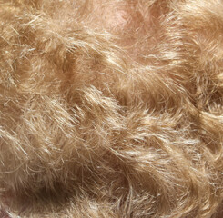 The image is of a person with blonde hair, and the hair appears to be very thick