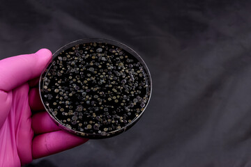 Microbiology. Hand with a pink glove and a bacterial culture plate. Black background. Space for text
