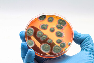 Microbiology. Hand with a blue glove and a culture plate with fungi or molds.