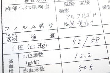 健康診断の血圧測定結果。収縮期95拡張期58の低血圧。