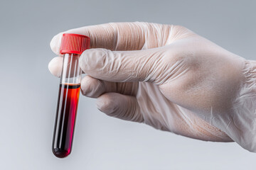 Hand wearing white glove holding test tube with red liquid against gray background blood sample medical