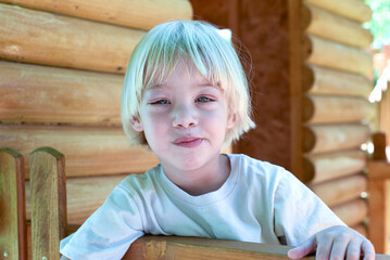 Portrait of a little boy with conjunctivitis.  3-year-old preschool child