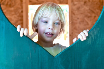 Portrait of a little boy with conjunctivitis.  3-year-old preschool child