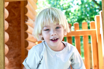 Portrait of a little boy with conjunctivitis.  3-year-old preschool child