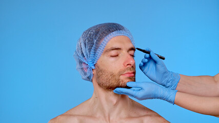 Preparation for Cosmetic Procedure with Surgical Marking Techniques