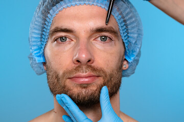 Preparation for Cosmetic Procedure with Surgical Marking Techniques