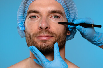 Preparation for Cosmetic Procedure with Surgical Marking Techniques