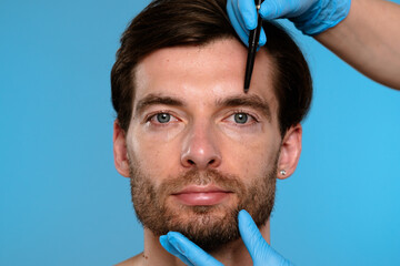 Preparation for Cosmetic Procedure with Surgical Marking Techniques