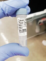 close up of holding an antibody