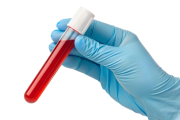 Gloved Hand Holding Blood Sample in Test Tube Medical Lab Analysis