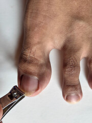 Cutting toenails with stainless steel nail clipper close-up of male foot
