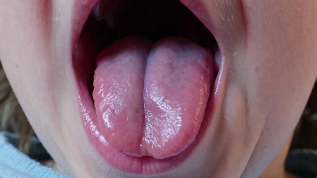 Close-Up of Child's Oral Cavity