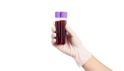 Gloved Hand Holding Blood Sample in Test Tube Medical Lab Analysis isolated on solid white background