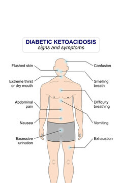 Diabetic Ketoacidosis (DKA) sign and symptoms