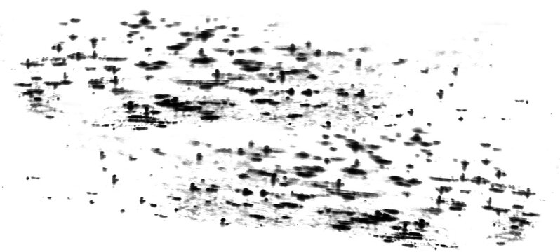 2D Gel Electrophoresis Image Protein Spot Analysis Proteomics Research on transparent background