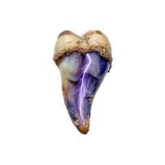 Electric Tooth A Surreal Image of a Decayed Tooth with a Bolt of Lightning