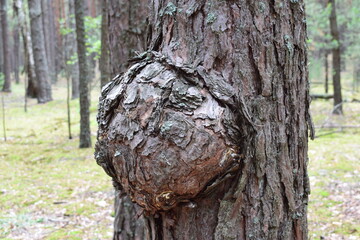 Large tree burl growing on the trunk of a pine in the forest. Natural wood deformity, rich bark...