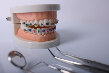 Orthodontic tools, brace, bracket system, tooth