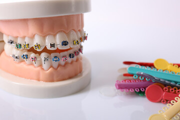 Orthodontic tools, brace, bracket system, tooth