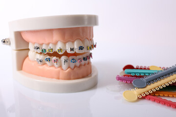 Orthodontic tools, brace, bracket system, tooth