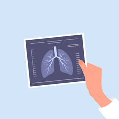 Fluorography concept. Doctor hand holding X Ray scanning. Health lungs check up. Vector illustration in flat cartoon style.