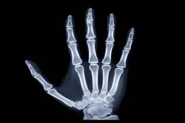 Naklejka premium x-default X-Ray Image of a Human Hand