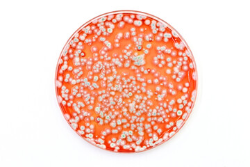 Mycology, a microbiological culture plate with colonies of fungi