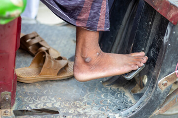 A young man put his foot on the car brake.