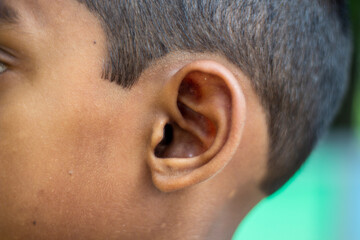A part of a human ear and some hair and the background blurred