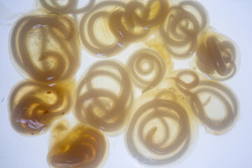 The nematodes (Nematoda), roundworms or eelworms constitute the phylum Nematoda. Species in the...