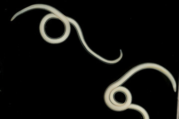 The nematodes (Nematoda), roundworms or eelworms constitute the phylum Nematoda. Species in the phylum inhabit a broad range of environments. Found in freshwater crabs.