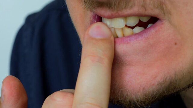 A person bites his fingernails because of will and stress.
Habit of biting nails.
Bad habit.
Stress and fear.