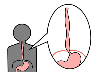 正常な食道　横隔膜