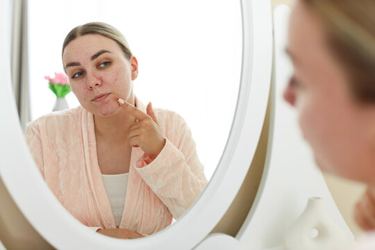 Woman with acne problem looking in mirror at home