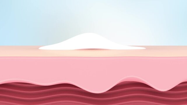 Acne treatment, itchy hands and arm with acne, white gel covers the pimples, penetrates under the skin to kill the fungus, soothes the acne redness, removes inflammation, skin care beauty solution. 3D