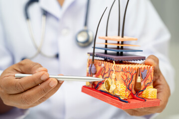 Hair transplant, Asian dermatologist doctor holding skin structure anatomy model for treatment in hospital.