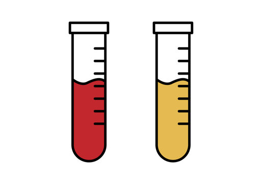 Probetas con muestras de sangre y orina