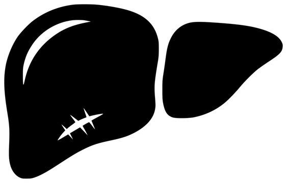 black liver with stitches clip art preview