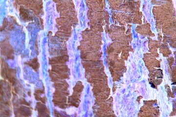 Psychedelic abstract texture of tree bark. A vibrant, colorful, and surreal background with natural patterns for creative design.