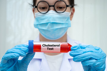 Scientist medical professional holding Cholesterol test tube blood for research in science...