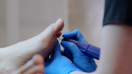 Podiatrist using blue gloves to operate a pedicure machine and remove calluses from patient's foot...