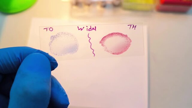 Test for Salmonella typhi and salmonella parratyphi, positive TO, TH result mean positive for salmonella typhi.
