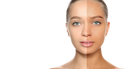 Fototapeta premium Before and after suntanning. Photo of woman divided into halves on white background. Banner design with space for text