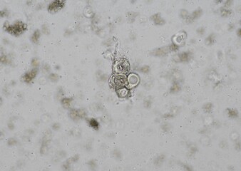 soil microorganisms under a microscope including amoeba, flagellates, nematodes, fungi, bacteria	
