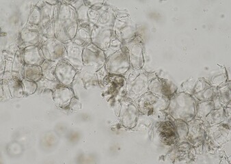 soil microorganisms under a microscope including amoeba, flagellates, nematodes, fungi, bacteria	
